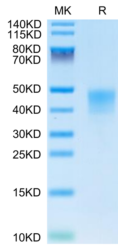 Human IFN alpha/beta R2 on Tris-Bis PAGE under reduced condition. The purity is greater than 95%.Recombinant Human IFN alpha/beta R2 Protein, Active