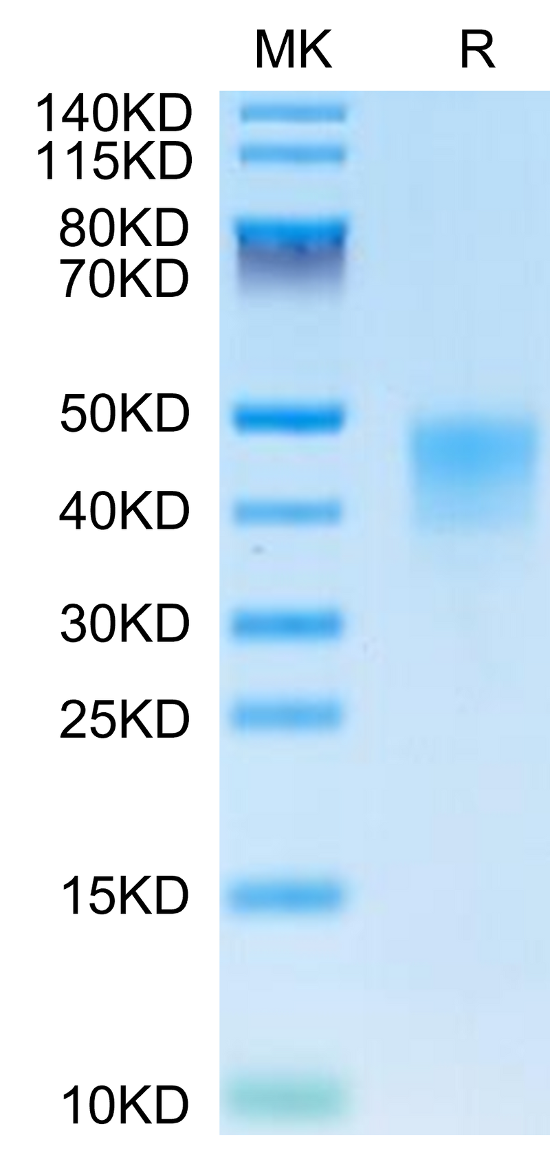Human IFN alpha/beta R2 on Tris-Bis PAGE under reduced condition. The purity is greater than 95%.Recombinant Human IFN alpha/beta R2 Protein, Active