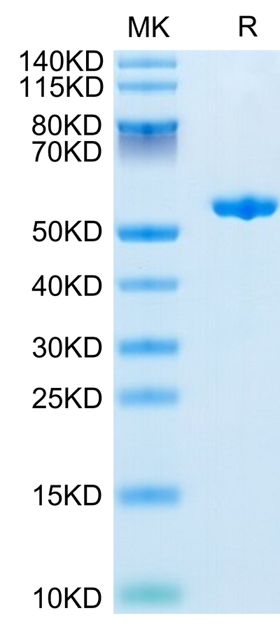 Human Complement Factor D on Tris-Bis PAGE under reduced condition. The purity is greater than 95%.Recombinant Human Complement Factor D/CFD Protein, Active