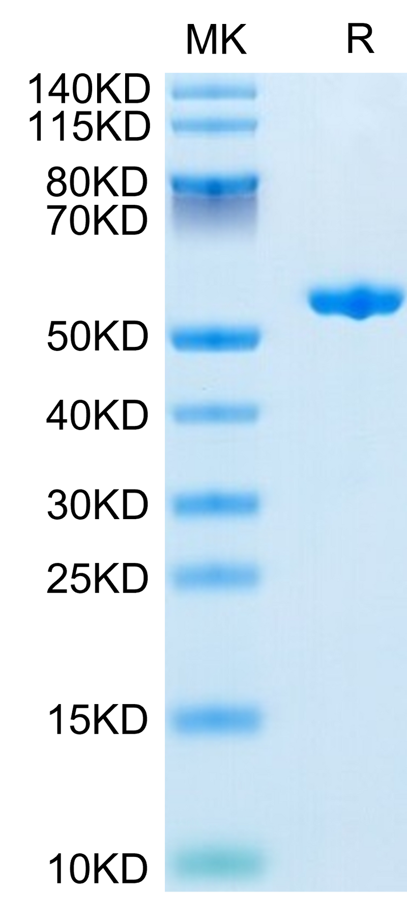Human Complement Factor D on Tris-Bis PAGE under reduced condition. The purity is greater than 95%.Recombinant Human Complement Factor D/CFD Protein, Active