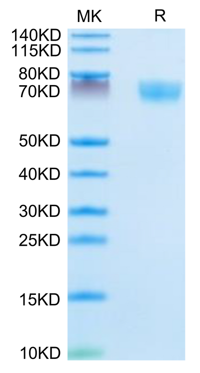 Mouse Complement Factor D on Tris-Bis PAGE under reduced condition. The purity is greater than 95%.Recombinant Mouse Complement Factor D/CFD Protein