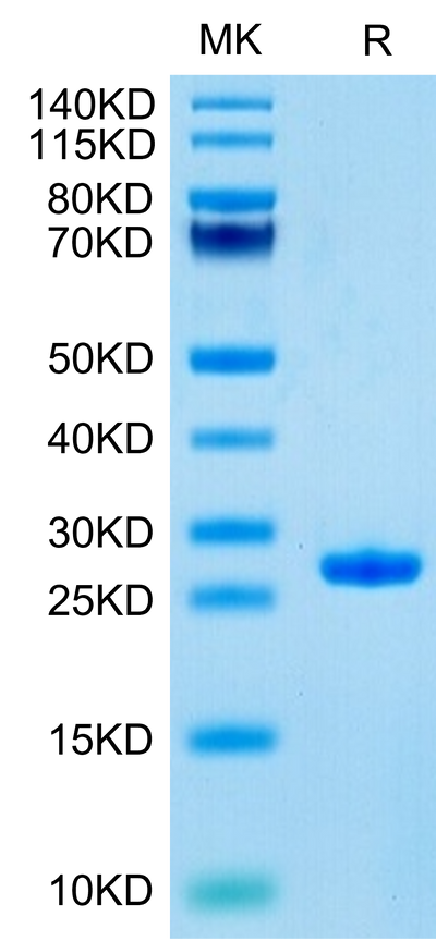 Human Complement Factor D on Tris-Bis PAGE under reduced condition. The purity is greater than 95%.Recombinant Human Complement Factor D/CFD Protein, Active