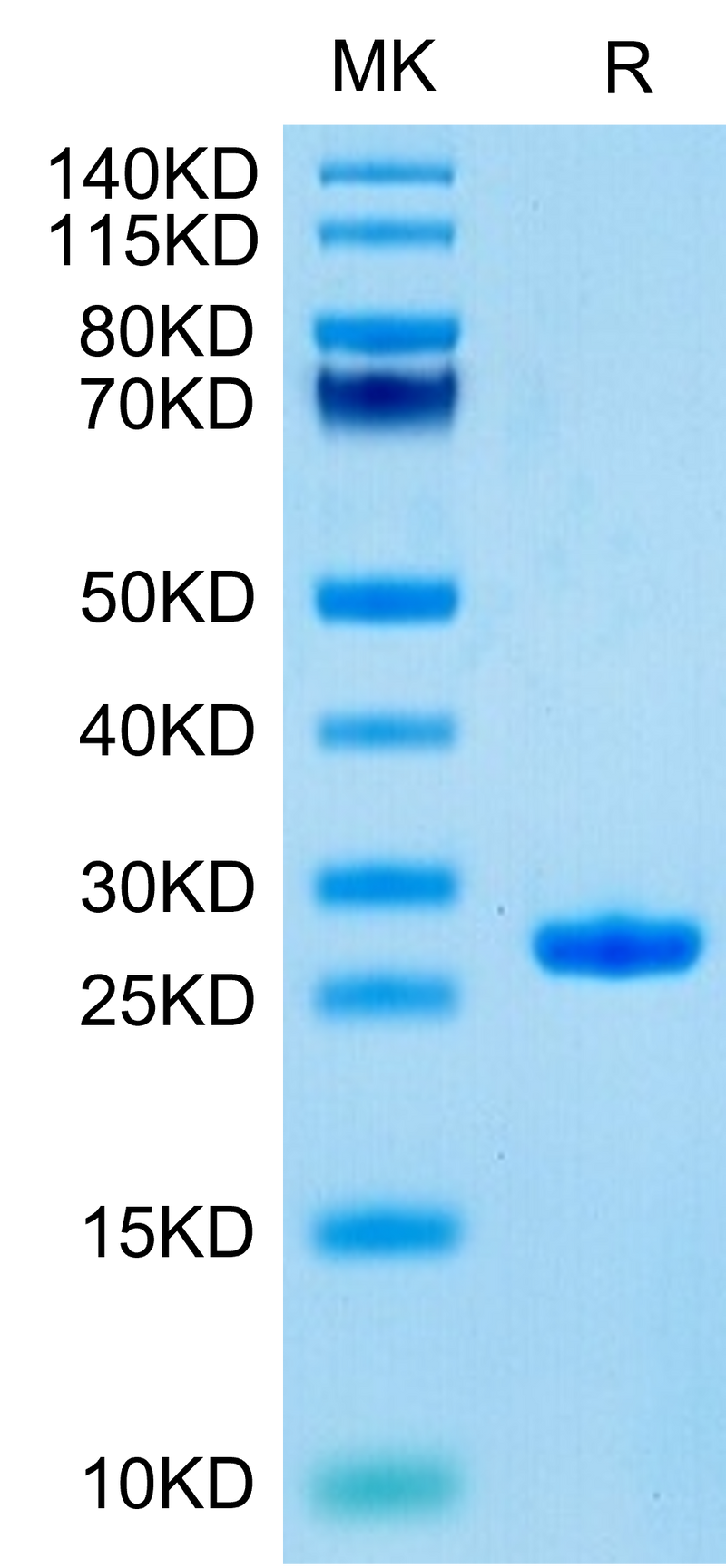 Human Complement Factor D on Tris-Bis PAGE under reduced condition. The purity is greater than 95%.Recombinant Human Complement Factor D/CFD Protein, Active