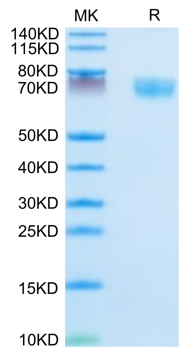 Mouse Complement Factor D on Tris-Bis PAGE under reduced condition. The purity is greater than 95%.Recombinant Mouse Complement Factor D/CFD Protein
