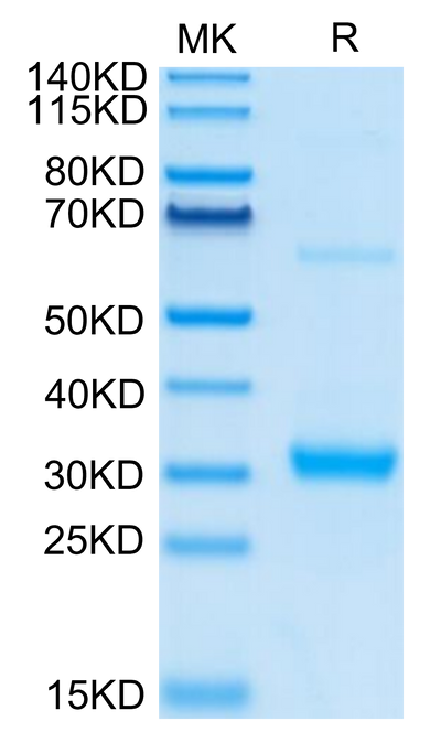 Human CLEC10A on Tris-Bis PAGE under reduced condition. The purity is greater than 95%.Recombinant Human CLEC10A Protein