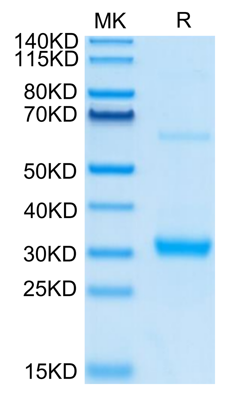 Human CLEC10A on Tris-Bis PAGE under reduced condition. The purity is greater than 95%.Recombinant Human CLEC10A Protein