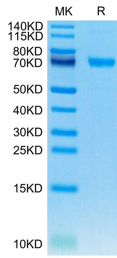Human IL-21R on Tris-Bis PAGE under reduced condition. The purity is greater than 95%.Recombinant Human IL-21R Protein, Active