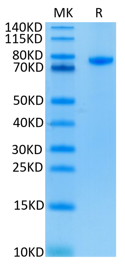 Human CD4 on Tris-Bis PAGE under reduced condition. The purity is greater than 95%.Recombinant Human CD4/LEU3 Protein, Active