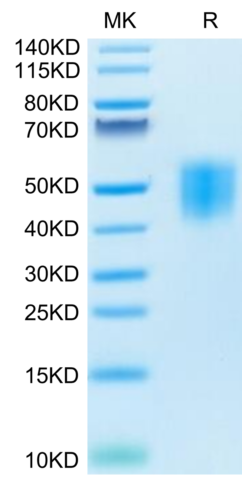 Human GHR on Tris-Bis PAGE under reduced condition. The purity is greater than 95%.Recombinant Human GHR/Growth Hormone R Protein