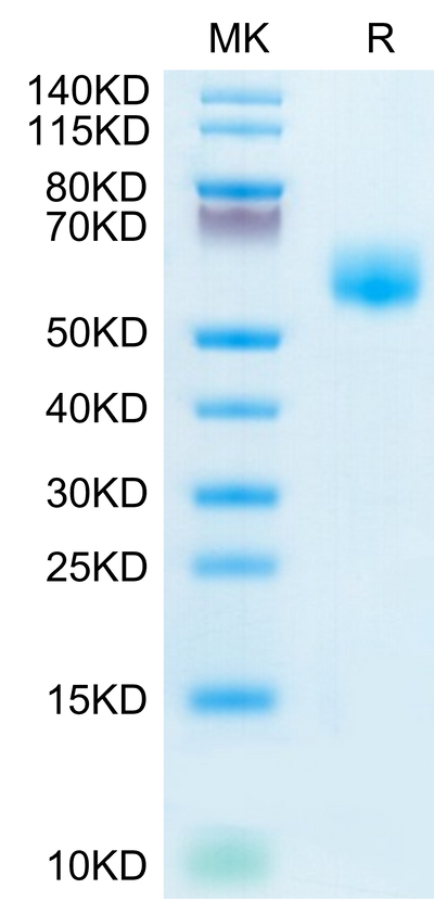Human IL-1RL1 on Tris-Bis PAGE under reduced condition. The purity is greater than 95%.Recombinant Human IL-1RL1/ST2 Protein, Active