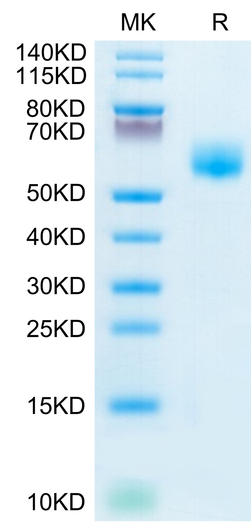 Human IL-1RL1 on Tris-Bis PAGE under reduced condition. The purity is greater than 95%.Recombinant Human IL-1RL1/ST2 Protein, Active