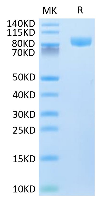 Human VCAM-1 on Tris-Bis PAGE under reduced condition. The purity is greater than 95%.Recombinant Human VCAM-1/CD106 Protein