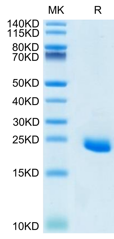 Human Ephrin-A4 on Tris-Bis PAGE under reduced condition. The purity is greater than 95%.Recombinant Human Ephrin-A4/EFNA4 Protein, Active