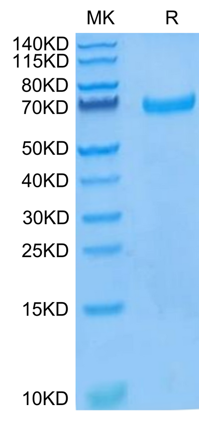 Human EphB4 on Tris-Bis PAGE under reduced condition. The purity is greater than 95%.Recombinant Human EphB4 Protein