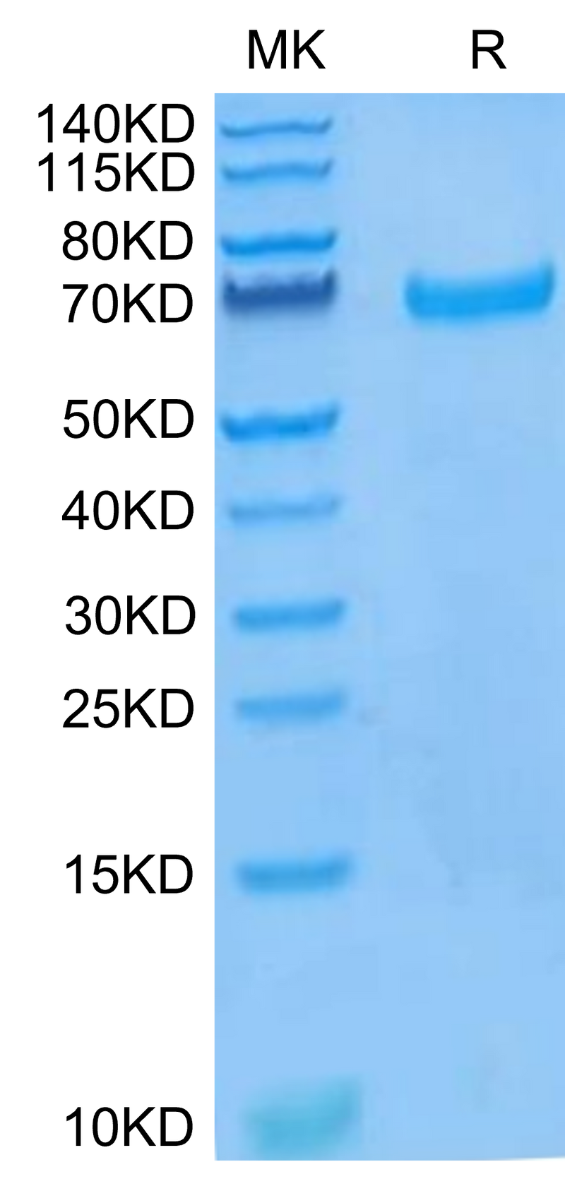 Human EphB4 on Tris-Bis PAGE under reduced condition. The purity is greater than 95%.Recombinant Human EphB4 Protein