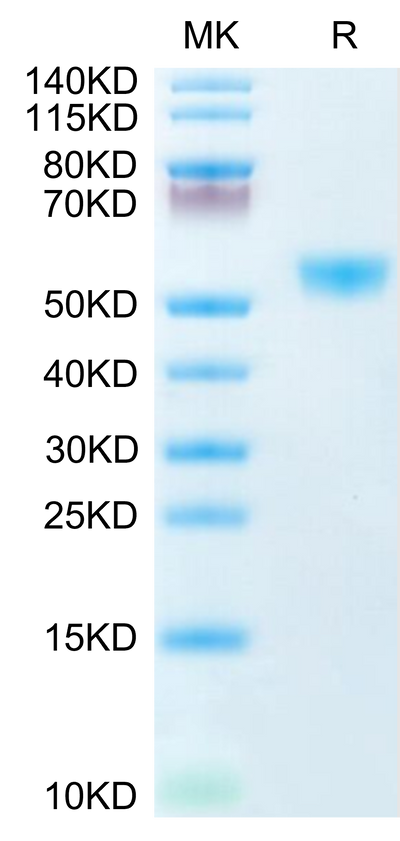 Human CD28H on Tris-Bis PAGE under reduced condition. The purity is greater than 95%.Recombinant Human CD28H/IGPR-1 Protein, Active