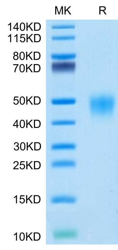 Cynomolgus Fc gamma RIII on Tris-Bis PAGE under reduced condition. The purity is greater than 95%.Recombinant Cynomolgus Fc gamma RIII/CD16 Protein, Active