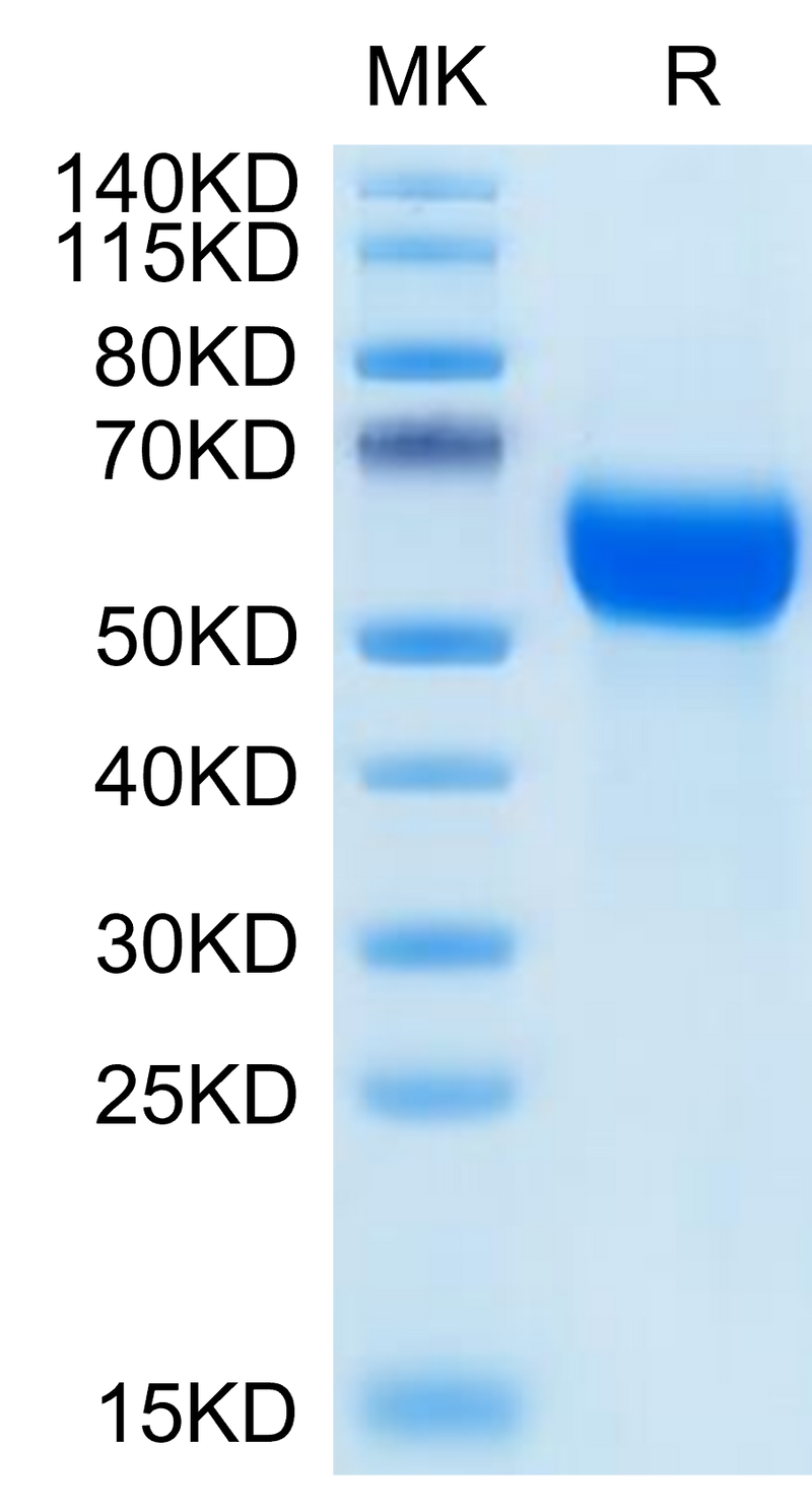 Human GFR alpha 1 on Tris-Bis PAGE under reduced condition. The purity is greater than 95%.Recombinant Human GFR alpha 1 Protein, Active