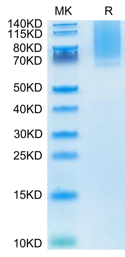 Human Glypican 1 on Tris-Bis PAGE under reduced condition. The purity is greater than 95%.Recombinant Human Glypican 1/GPC1 Protein, Active