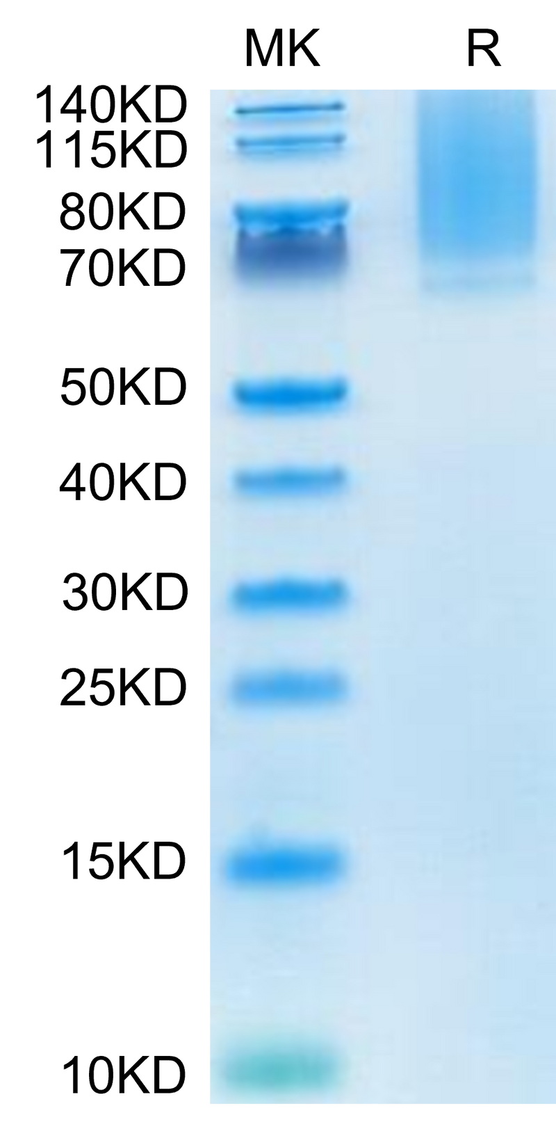 Human Glypican 1 on Tris-Bis PAGE under reduced condition. The purity is greater than 95%.Recombinant Human Glypican 1/GPC1 Protein, Active