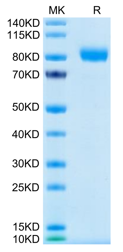 Human GM-CSF R alpha on Tris-Bis PAGE under reduced condition. The purity is greater than 95%.Recombinant Human GM-CSF R alpha Protein, Active