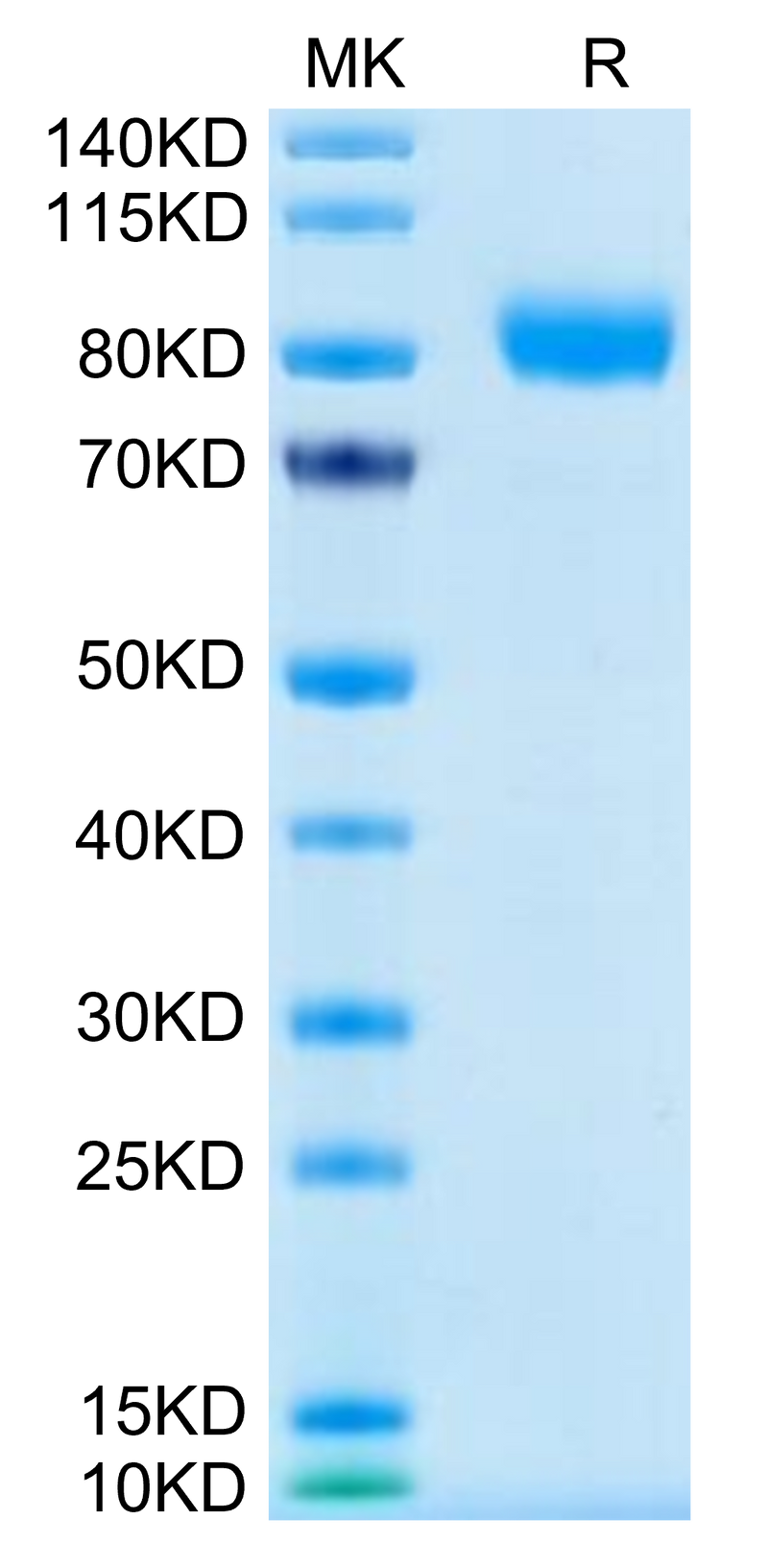 Human GM-CSF R alpha on Tris-Bis PAGE under reduced condition. The purity is greater than 95%.Recombinant Human GM-CSF R alpha Protein, Active