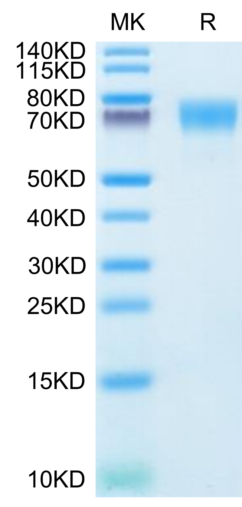 Human ICAM-1 on Tris-Bis PAGE under reduced condition. The purity is greater than 95%.Recombinant Human ICAM-1/CD54 Protein, Active