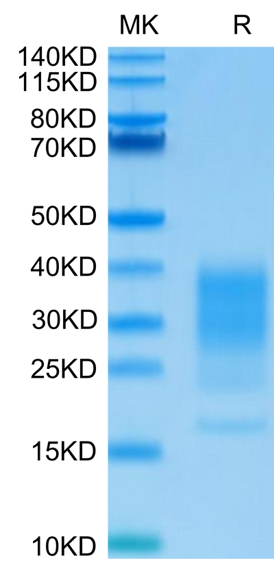 Human IL-22 on Tris-Bis PAGE under reduced condition. The purity is greater than 95%.Recombinant Human IL-22 Protein, Active