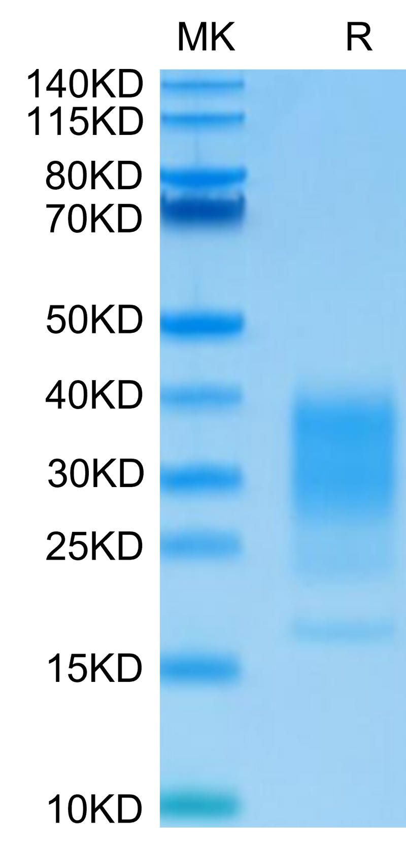 Human IL-22 on Tris-Bis PAGE under reduced condition. The purity is greater than 95%.Recombinant Human IL-22 Protein, Active