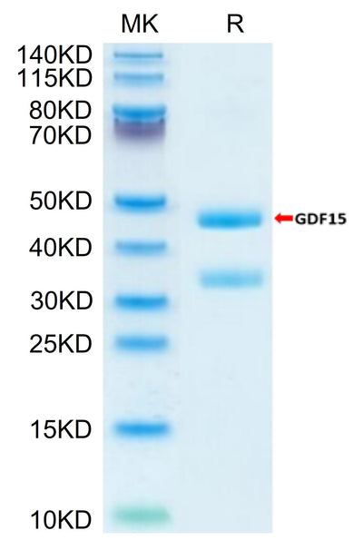 Biotinylated Mouse GDF15 on Tris-Bis PAGE under reduced condition. The purity is greater than 95%.Biotinylated Mouse GDF15 Protein (Primary Amine Labeling), Active