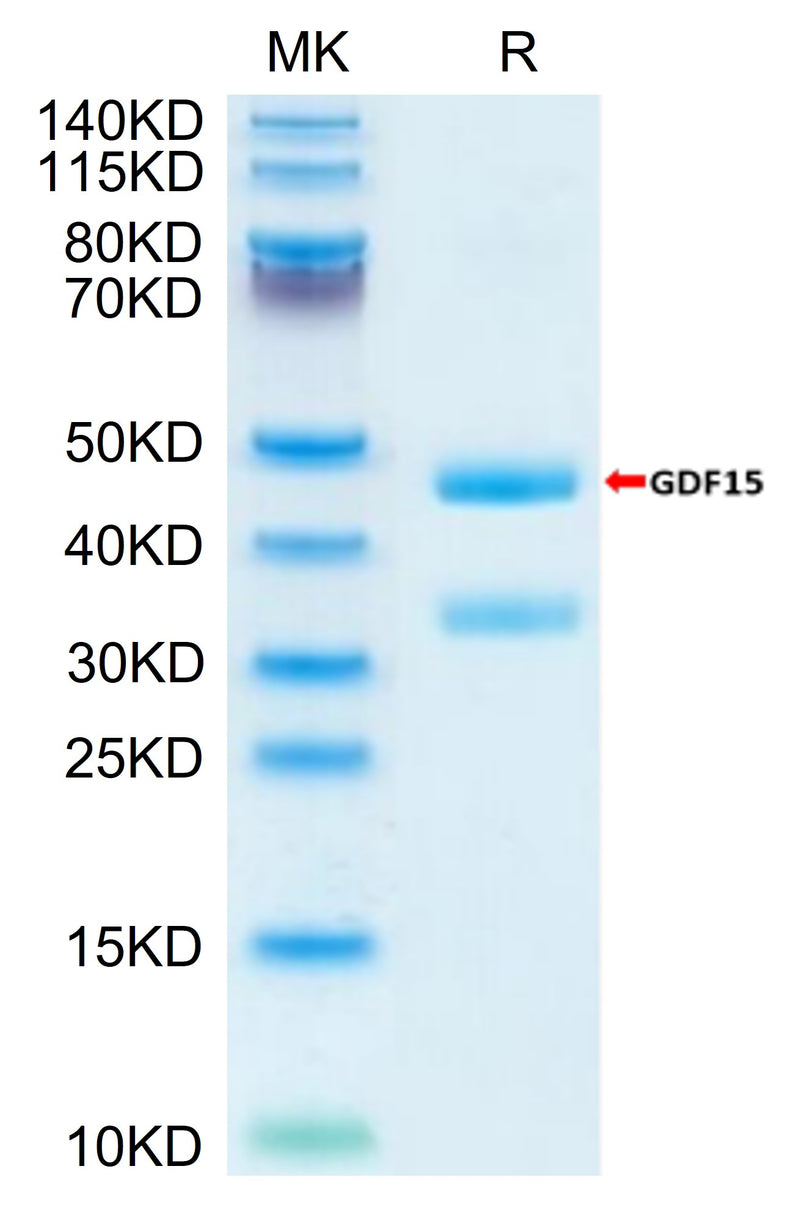 Biotinylated Mouse GDF15 on Tris-Bis PAGE under reduced condition. The purity is greater than 95%.Biotinylated Mouse GDF15 Protein (Primary Amine Labeling), Active