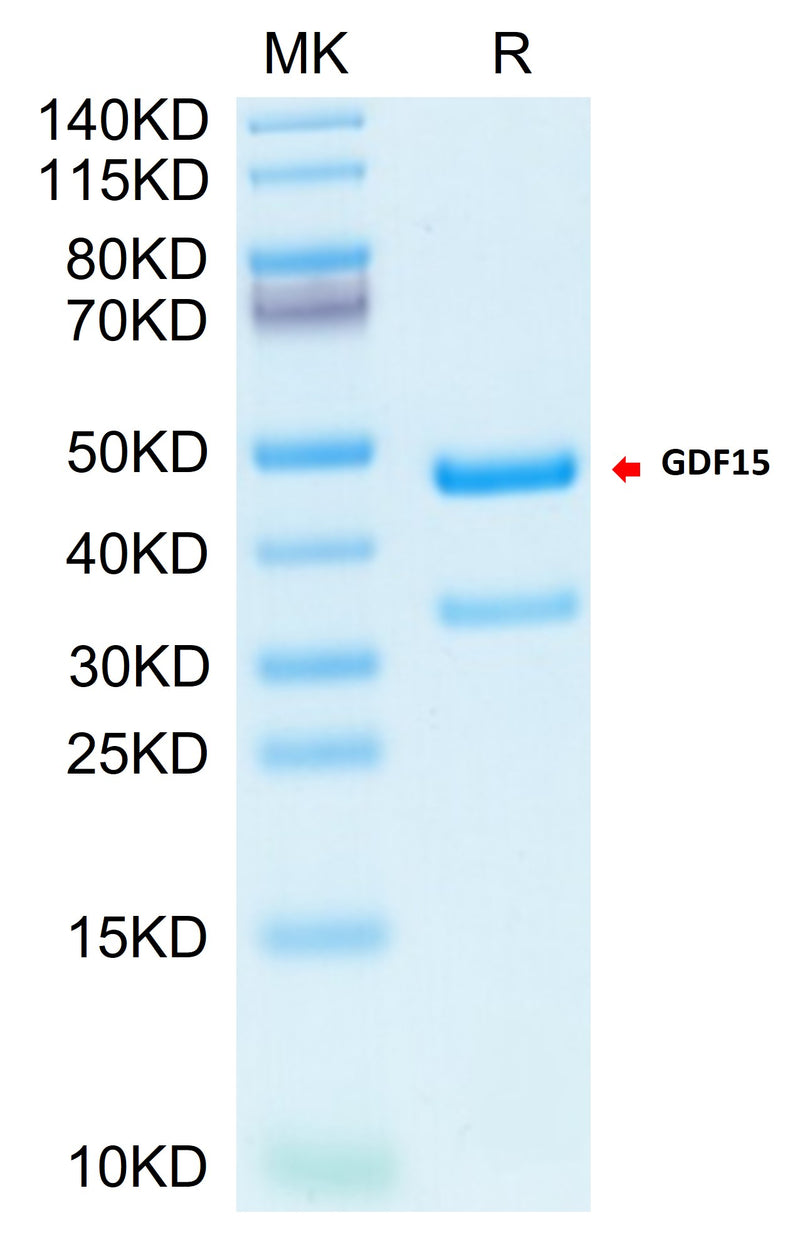 Biotinylated Cynomolgus GDF15 on Tris-Bis PAGE under reduced condition. The purity is greater than 95%.Biotinylated Cynomolgus GDF15 Protein (Primary Amine Labeling), Active