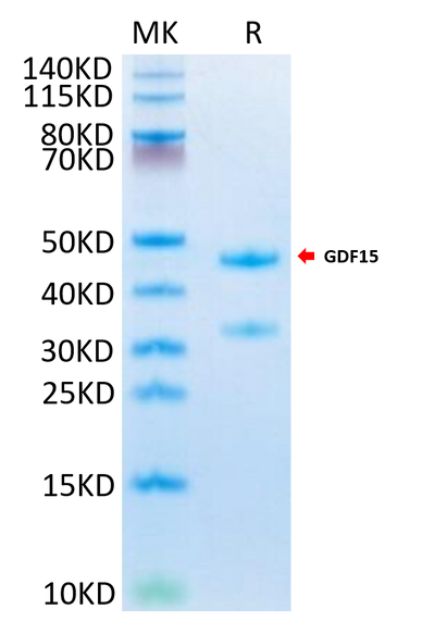 Mouse GDF15 on Tris-Bis PAGE under reduced condition. The purity is greater than 95%.Recombinant Mouse GDF15 Protein, Active