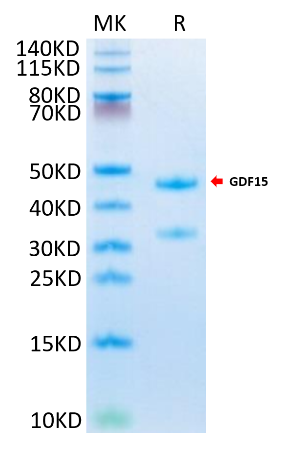 Mouse GDF15 on Tris-Bis PAGE under reduced condition. The purity is greater than 95%.Recombinant Mouse GDF15 Protein, Active