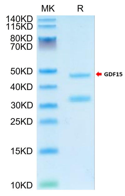 Cynomolgus GDF15 on Tris-Bis PAGE under reduced condition. The purity is greater than 95%.Recombinant Cynomolgus GDF15 Protein, Active