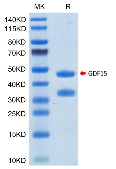 Biotinylated Human GDF15 on Tris-Bis PAGE under reduced condition. The purity is greater than 95%.Biotinylated Human GDF15 Protein (Primary Amine Labeling), Active