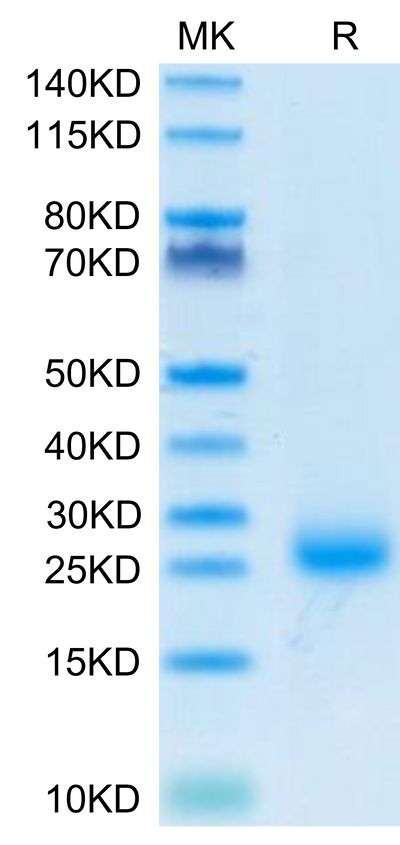 Cynomolgus IL-31 on Tris-Bis PAGE under reduced condition. The purity is greater than 95%.Recombinant Cynomolgus IL-31 Protein, Active