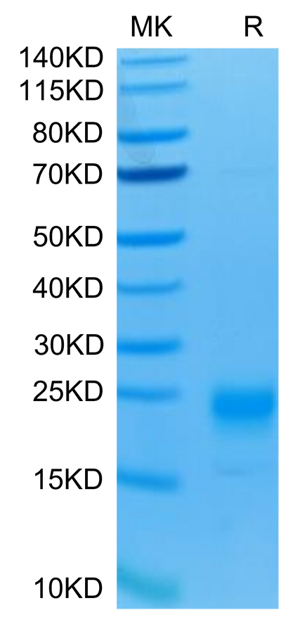 Human IL-5 on Tris-Bis PAGE under reduced condition. The purity is greater than 95%.Recombinant Human IL-5 Protein, Active