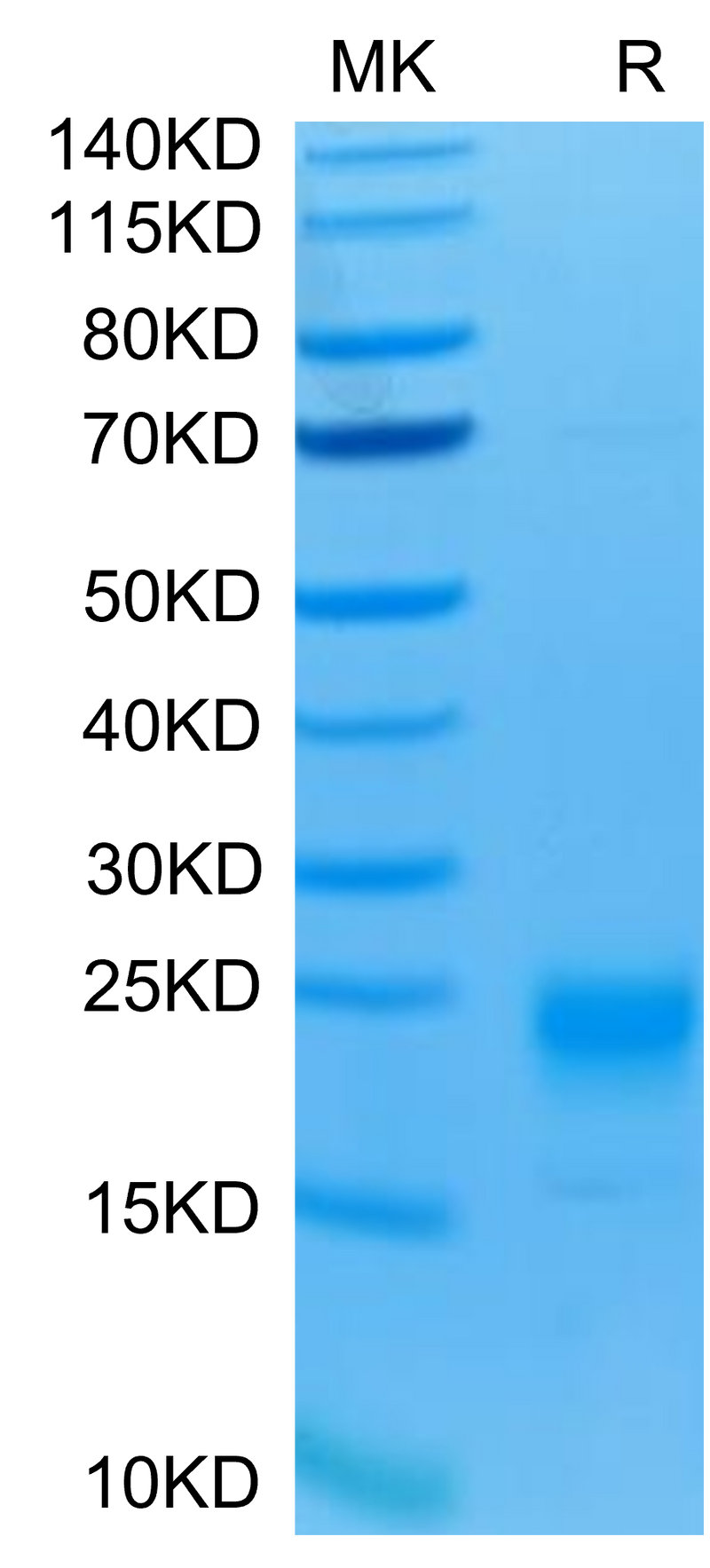 Human IL-5 on Tris-Bis PAGE under reduced condition. The purity is greater than 95%.Recombinant Human IL-5 Protein, Active