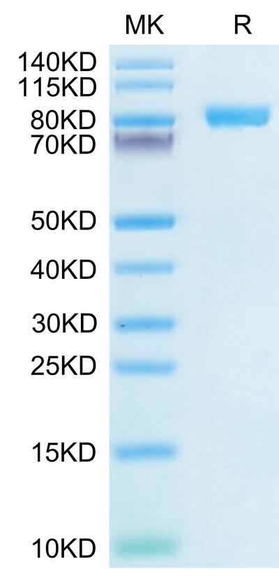 Human IL-6 R alpha on Tris-Bis PAGE under reduced condition. The purity is greater than 95%.Recombinant Human IL-6 R alpha/CD126 Protein, Active