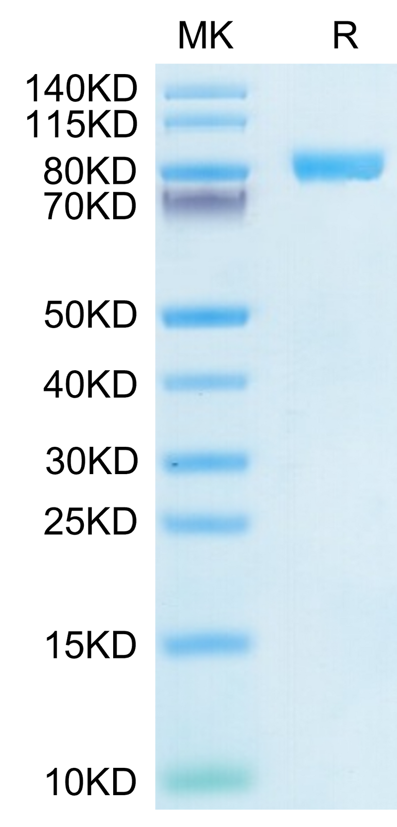 Human IL-6 R alpha on Tris-Bis PAGE under reduced condition. The purity is greater than 95%.Recombinant Human IL-6 R alpha/CD126 Protein, Active