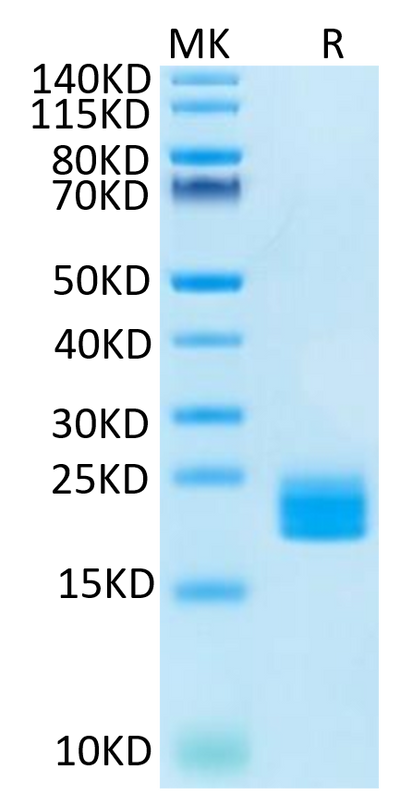 Huma LAIR2 on Tris-Bis PAGE under reduced condition. The purity is greater than 95%.Recombinant Huma LAIR2/CD306 Protein, Active