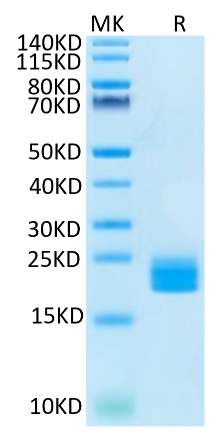 Huma LAIR2 on Tris-Bis PAGE under reduced condition. The purity is greater than 95%.Recombinant Huma LAIR2/CD306 Protein, Active