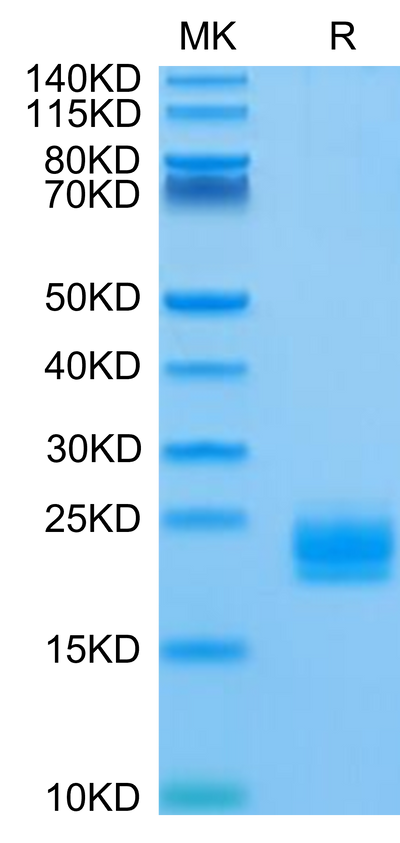Biotinylated Huma LAIR2 on Tris-Bis PAGE under reduced condition. The purity is greater than 95%.Biotinylated Human LAIR2/CD306 Protein, Active