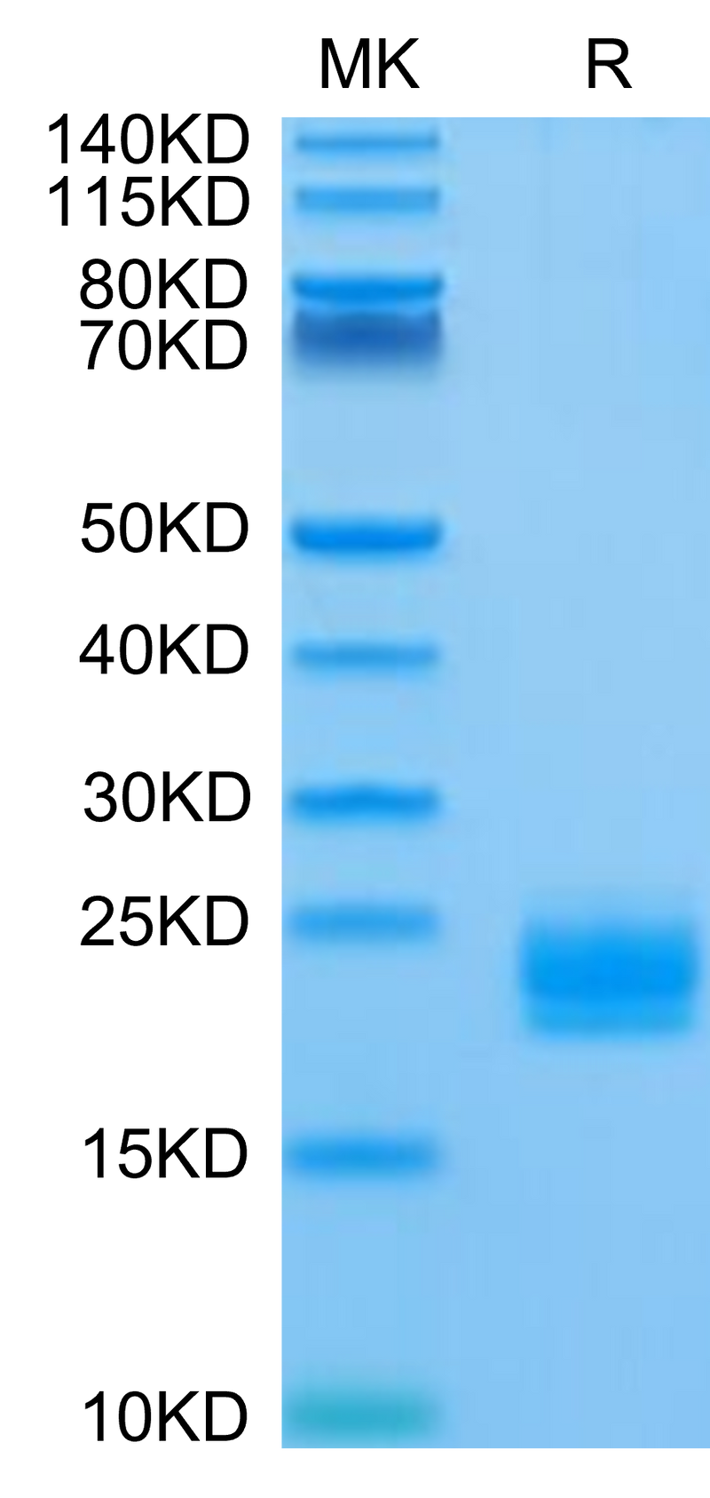 Biotinylated Huma LAIR2 on Tris-Bis PAGE under reduced condition. The purity is greater than 95%.Biotinylated Human LAIR2/CD306 Protein, Active
