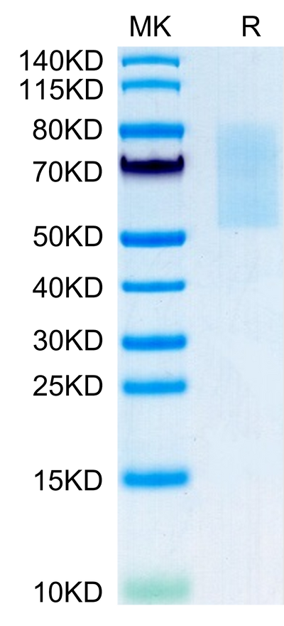 Mouse CX3CL1 on Tris-Bis PAGE under reduced condition. The purity is greater than 95%.Recombinant Mouse CX3CL1/Fractalkine Protein