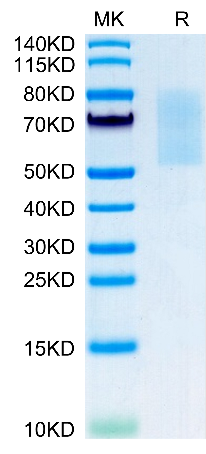 Mouse CX3CL1 on Tris-Bis PAGE under reduced condition. The purity is greater than 95%.Recombinant Mouse CX3CL1/Fractalkine Protein