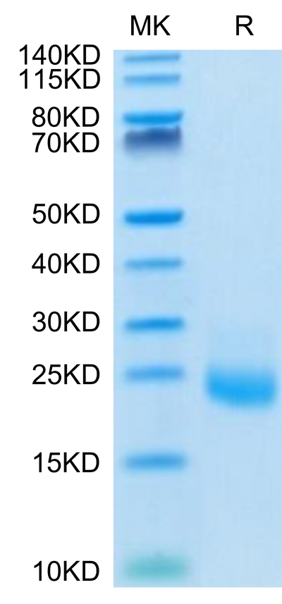 Human IL-31 on Tris-Bis PAGE under reduced condition. The purity is greater than 95%.Recombinant Human IL-31 Protein, Active