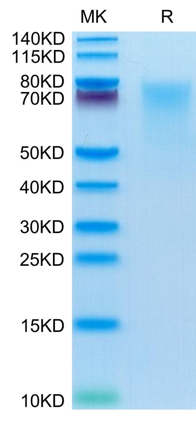 Human BSPII on Tris-Bis PAGE under reduced condition. The purity is greater than 95%.Recombinant Human BSPII Protein