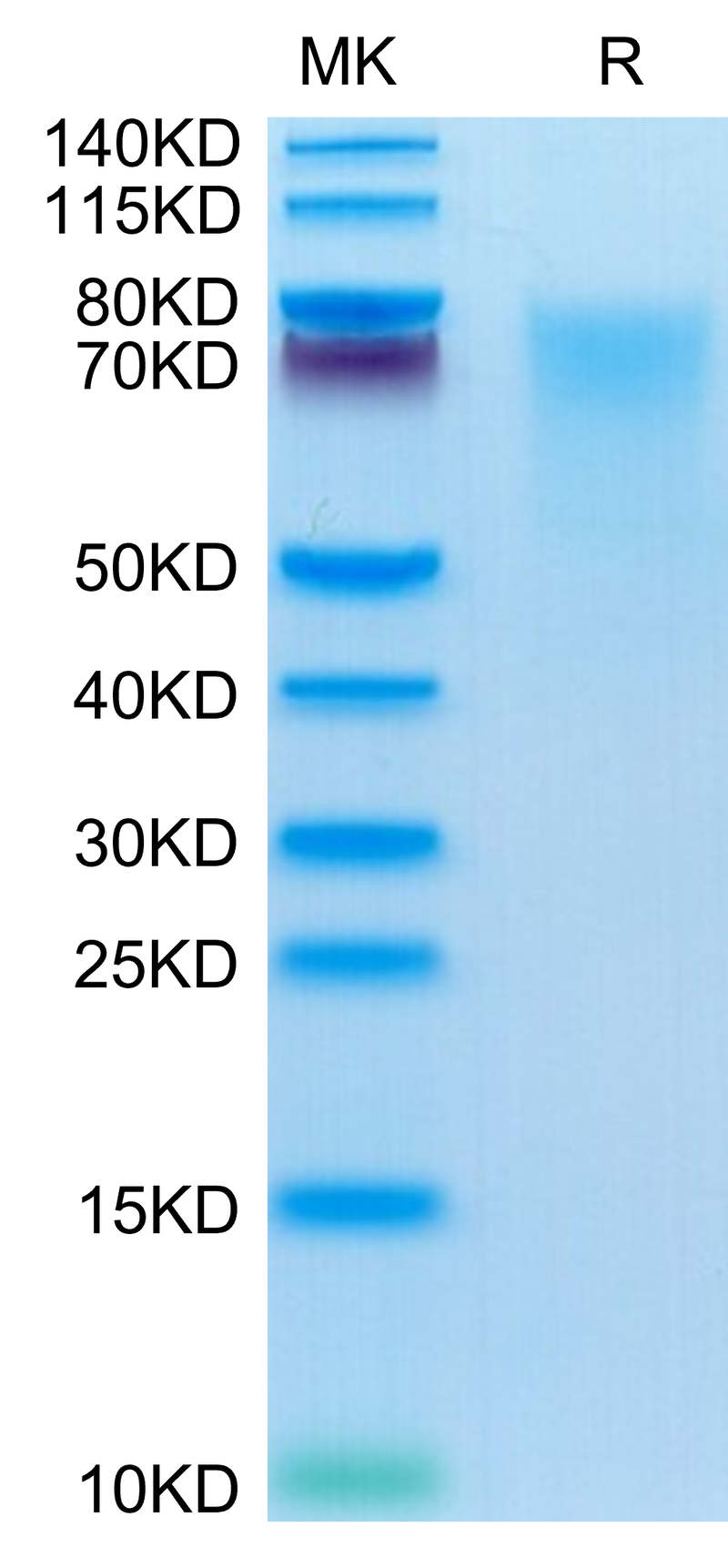 Human BSPII on Tris-Bis PAGE under reduced condition. The purity is greater than 95%.Recombinant Human BSPII Protein